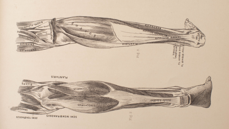 Why Single-Leg Training is Non-Negotiable for Strength and Athletic Performance